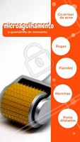 O microagulhamento tem sido eleito o tratamento queridinho das famosas, e não é por acaso! O tratamento é capaz de tratar diversos problemas do rosto. Agende sua avaliação e inicie o tratamento! #microagulhamento #ahazou #esteticafacial