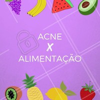 🍎 Inclua: zinco (ovos, carnes vermelhas magras). Selênio (pão integral e aveia). Ômega 3 (Sardinha, atum, linhaça). Vitamina A (Cenoura, abóbora, couve). Vitamina C (Laranja, goiaba, mamão). Vitamina E (Semente de girassol, ovo);
🍕 Evite: chocolate, leite, frituras em geral, açúcar refinado, carnes vermelhas gordas (picanha, cupim e alcatra) e refrigerantes. #acne #ahazou #esteticafacial #alimentaçao #cuidadoscomapele