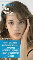#stories #ahazou #esteticafacial
