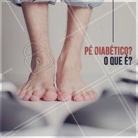 Pessoas com diabetes tem tendência a ter feridas nos pés. Essas feridas tem difícil cicatrização por conta dos níveis elevados de açúcar no sangue. É necessário procurar um especialista para cuidar deste problema. Fique atento aos sintomas! #diabetes #podologia #ahazou #pes #pediabetico