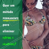 Conheça a camuflagem de estrias e cicatriz! O procedimento de camuflagem é basicamente uma tatuagem, que cobre perfeitamente a cicatriz. Venha conhecer o metódo. #esteticacorporal #ahazou #estrias #camuflagem