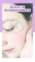 Quinta é dia de tratar cicatrizes de acne, manchas, flacidez e muito mais com o microagulhamento! Aproveite o preço especial só nessa quinta-feira. #esteticafacial #ahazou #microagulhamento
