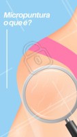 A micropuntura é um procedimento estético que consciente em estimular a pele através de um aparelho chamado dermógrafo, cada estria é trabalhada individualmente com este equipamento, a fim de estimular o organismo a entender que aquela é uma área do corpo que deve ser regenerada. Também é utilizado um fluido de colágeno diretamente nas estrias que melhora a elasticidade, firmeza e a hidratação da pele. #micropuntura #estrias #ahazouestetica #esteticacorporal