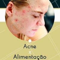 🍎 Inclua: zinco (ovos, carnes vermelhas magras). Selênio (pão integral e aveia). Ômega 3 (Sardinha, atum, linhaça). Vitamina A (Cenoura, abóbora, couve). Vitamina C (Laranja, goiaba, mamão). Vitamina E (Semente de girassol, ovo); 🍕 Evite: chocolate, leite, frituras em geral, açúcar refinado, carnes vermelhas gordas (picanha, cupim e alcatra) e refrigerantes. #acne #ahazou #esteticafacial #alimentaçao #cuidadoscomapele