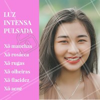 Dê adeus para esses e outros probleminhas de pele com a luz intensa pulsada! A tecnologia desse tratamento é capaz de diminuir e até acabar com esses incomôdos. Agende seu horário! #luzintensapulsada #ahazou #esteticafacial #estetica