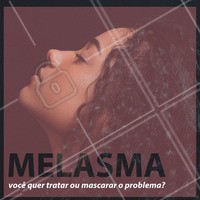 Sardinhas e pintas na pele do rosto podem até ser charmosas e atualmente até existem maquiagens que dão esse efeito na pele. No entanto, algumas manchas mais visíveis, como o melasma costumam causar muito incômodo. Elas são manchas acastanhadas que não coçam ou doem, não são uma doença, mas podem afetar a autoestima de quem a apresenta. Não se sabe ao certo o que causa o melasma, mas alguns fatores certamente estão relacionados ao problema. O sol está sempre envolvido em seu aparecimento, já que é ele que superestimula as células produtoras de pigmento! O melasma pode ser tratado de várias maneiras diferentes, basta escolher a que melhor se adequa a você. Ligue e conheça os tratamentos que disponibilizamos para auxiliar no combate ao melasma! #melasma #sol #sun #manchas #rosto #sardas #pintas #dicas #estetica #estéticafacial #esteticaporamor #esteticista #ahazou #braziliangal #face #skincare #raiosuv #tratamento #tratamentofacial