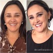 Antes e depois