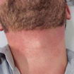 depilação barba (depois)#barbamodelada