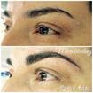 Microblading