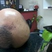micropigmentação