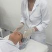 ProcedimentoFoi feita uma Limpeza de pele profunda na pele acneica , procedimenso feito no curso profissionalizante de estética fácil que é concluído no mês de Agosto . 