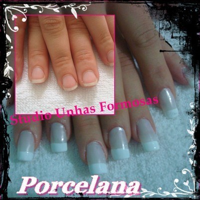Unhas de Porcelana 
Como as unhas de porcelana são aplicadas?

Para que as unhas de porcelana sejam aplicadas, primeiramente é necessário preparar as unhas naturais, cortando-as bem curtas e fazendo a higienização com um produto próprio para isso. Isso garante que não restem sujeiras embaixo das próteses, evitando, assim, o aparecimento de fungos e a proliferação de bactérias. Depois da higienização, as unhas devem ser polidas para remover a oleosidade natural, que pode dificultar a aderência das unhas de porcelana. 

Na hora de aplicar a unha artificial, a pessoa pode escolher entre dois modelos possíveis: 

    Tips, que são extensores naturais das unhas, aplicadas somente na ponta do dedo
    Moldes, que cobram totalmente a unha natural e são esculpidos para se ajustar perfeitamente nas mãos.

Mas, antes de as unhas de porcelana serem finalmente coladas, um produto de limpeza é aplicado sobre as unhas originais para evitar o surgimento de fungos. Por último, é só colar as unhas de porcelana e pronto. 
 manicure e pedicure designer de sobrancelhas maquiador(a) consultor(a)