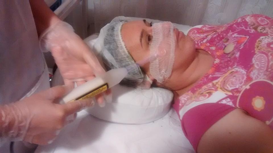 Alta Frequêcia Após a limpeza é utilizado o aparelho de eletroterapia. Ideal para fechar os poros, acalmar a pele, e promover uma camada protetora contra os fungos. esteticista depilador(a) designer de sobrancelhas estudante massagista terapeuta visagista