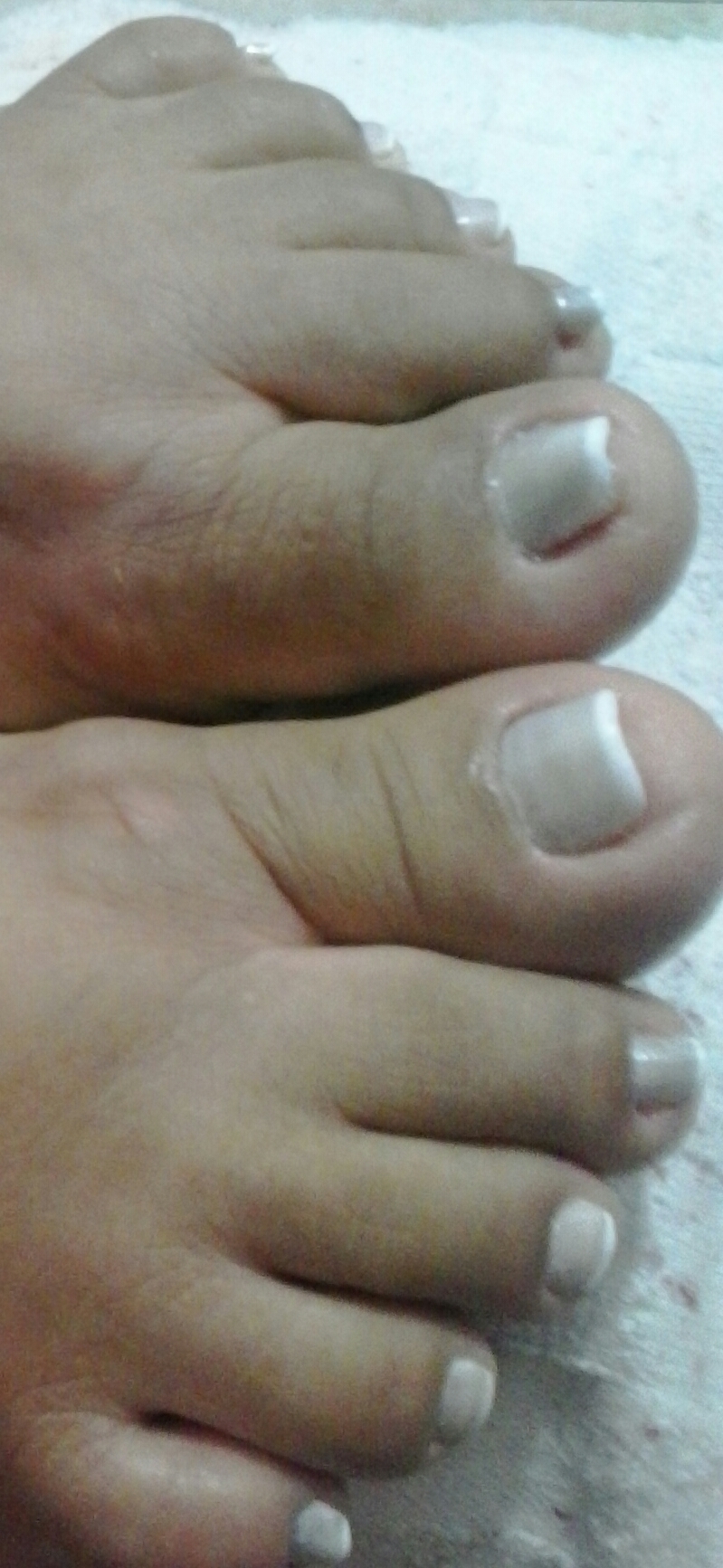 Unha encravada e micose (finalização) A mesma cliente q estava com a unha encravada e micose, ficou suuper satisfeita! manicure e pedicure