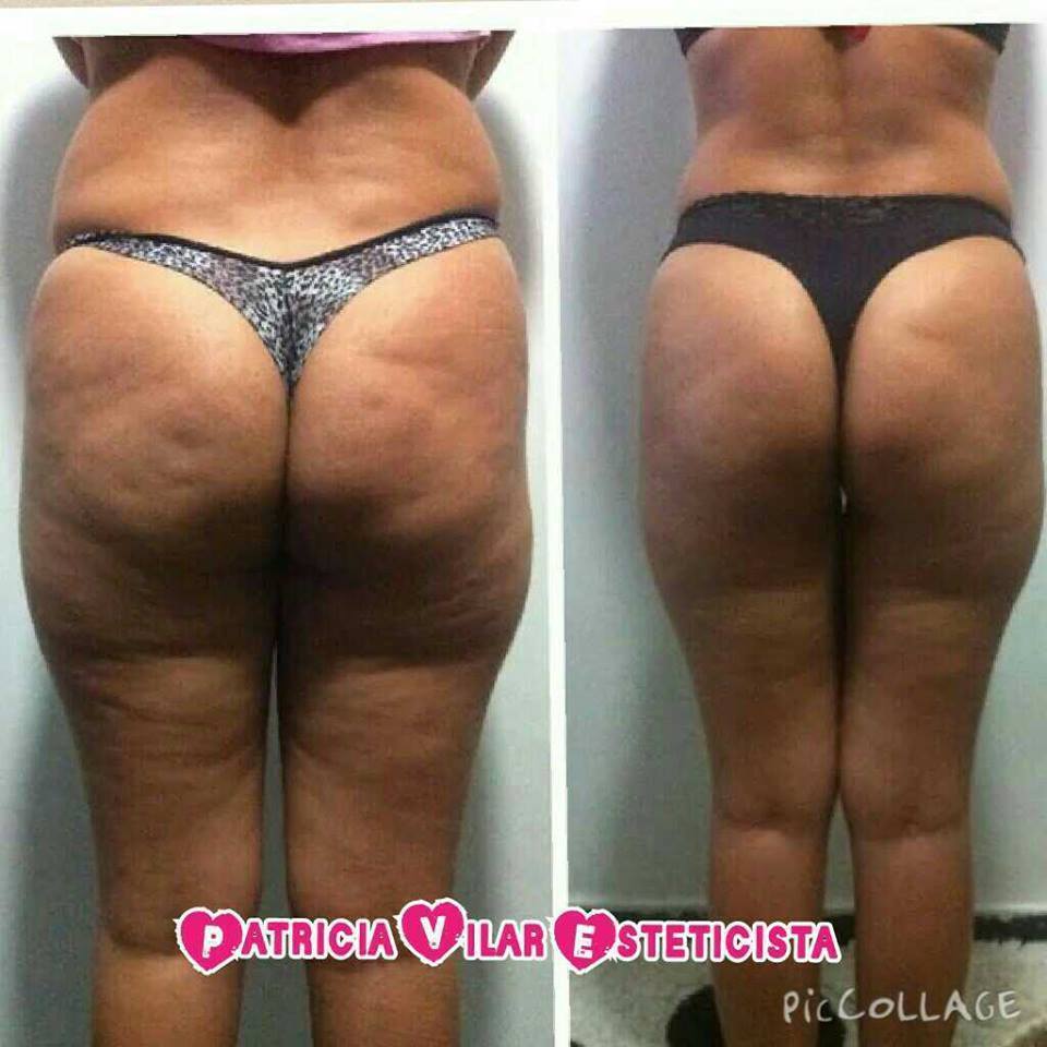 esteticista