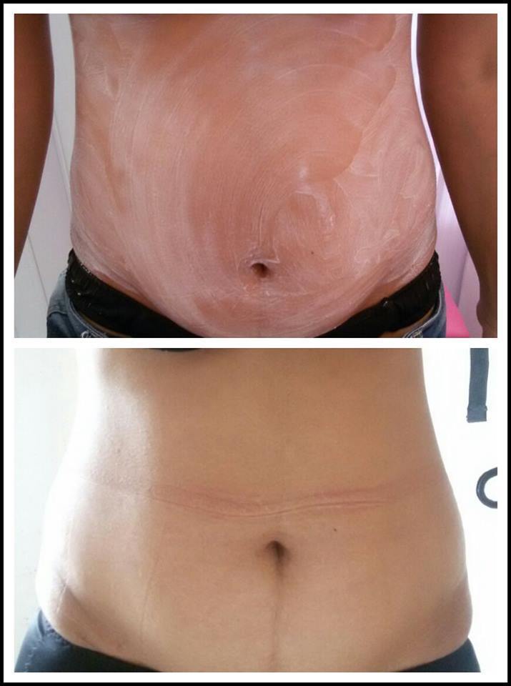esteticista