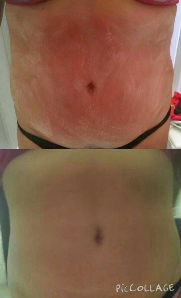 esteticista