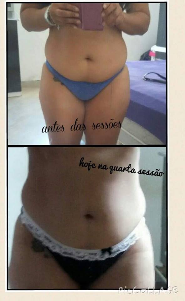 esteticista