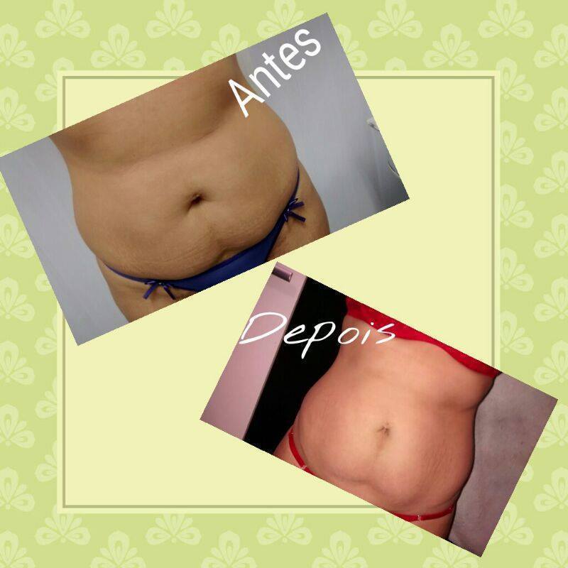 esteticista