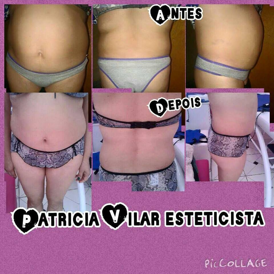 esteticista