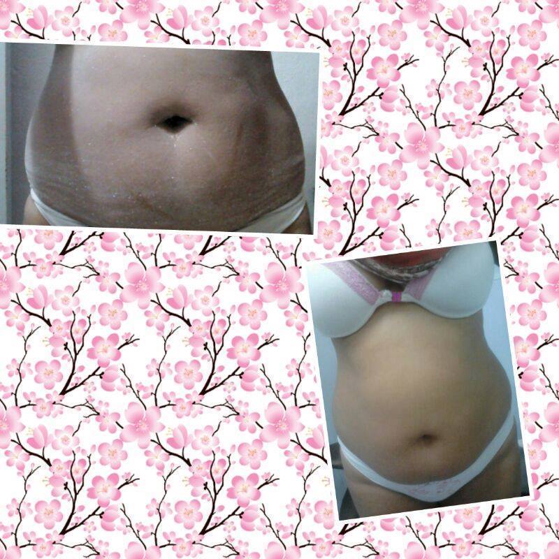 esteticista