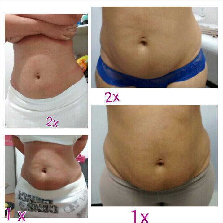 esteticista