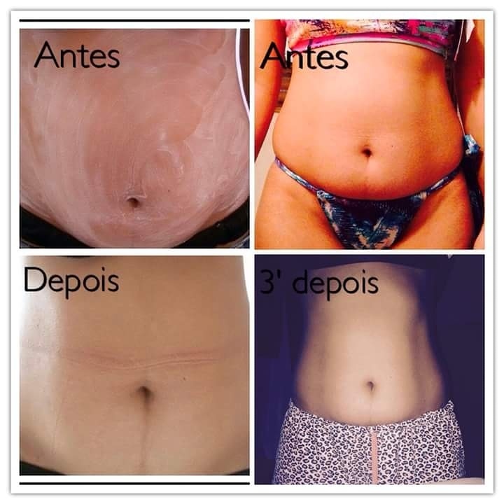 esteticista