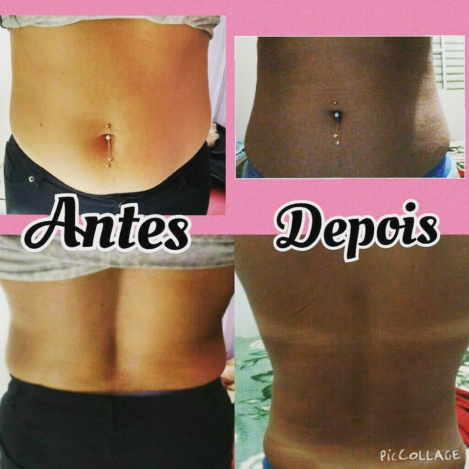 esteticista
