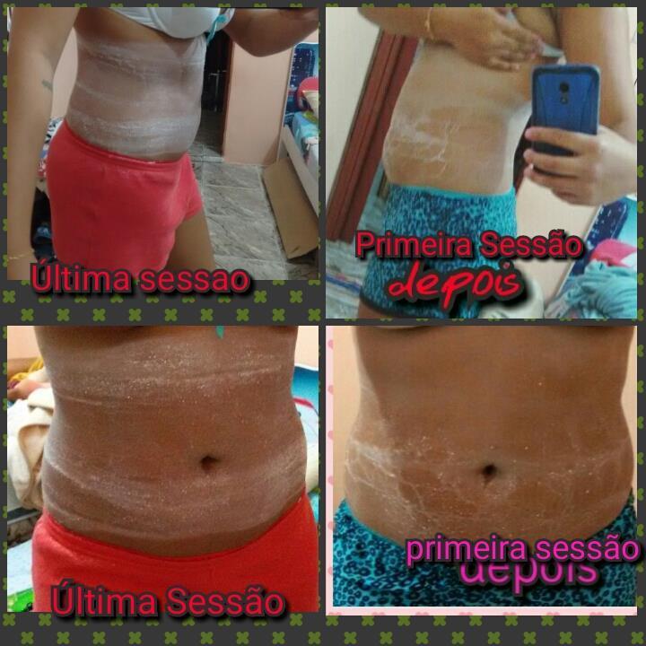 esteticista
