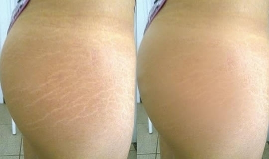 esteticista maquiador(a) cabeleireiro(a) designer de sobrancelhas manicure e pedicure depilador(a)