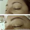 Antes e depois fio a fio! #fioafio #microfioafio #micropigmentacao