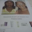 #tratamento racco,clareamento facial,resultado potente!!