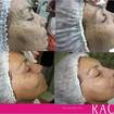 #Marmorizaçao Facial,Racco!!