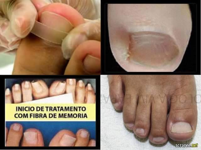 podólogo(a) manicure e pedicure