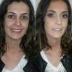 A pele bem preparada faz toda a diferênça.