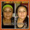 #limpezadepeleracco
Pele linda e radiante
Cuidar da beleza faz parte!!