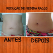 #reducaodemedidas
#reduzacelulite
#comdmae
#resultadogarantido