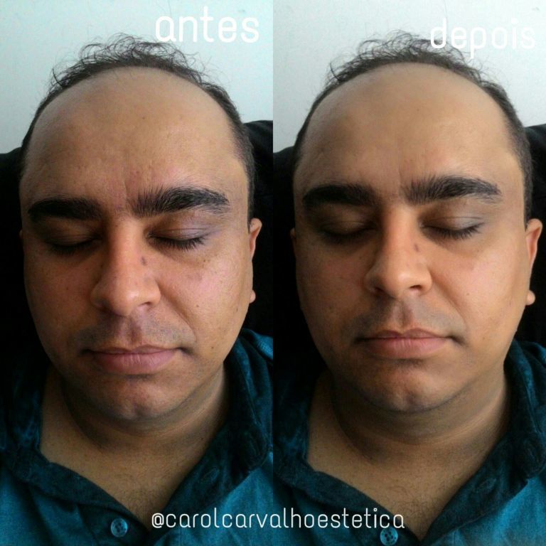 Hidratação Facial estética esteticista designer de sobrancelhas maquiador(a)