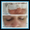 #limpezadepele
#esteticalaisrosas
#amoestetica
