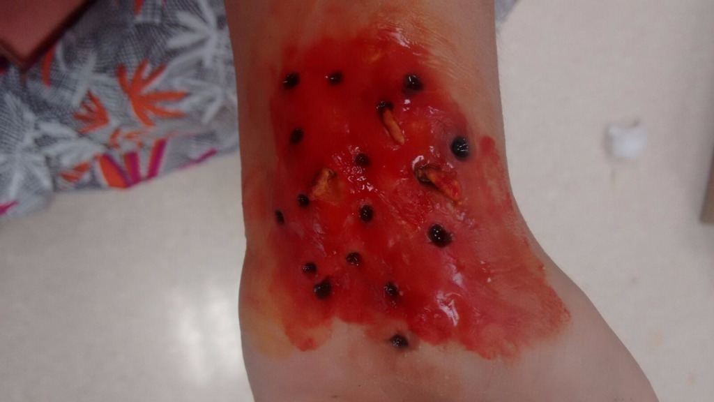 Slug - Bichinhos na pele maquiador(a) estudante (massoterapeuta) outros