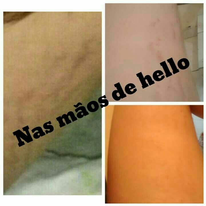 estética esteticista massoterapeuta