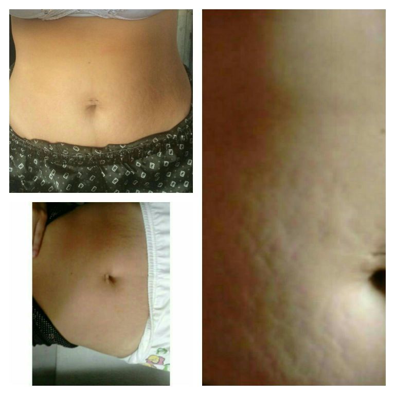 estética esteticista massoterapeuta