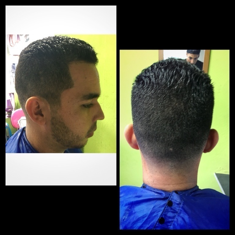 Dedrade básico e barba na navalha ✂️💈 barbeiro(a)