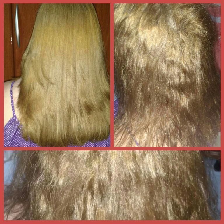 Lipoescultura capilar cabelo cabeleireiro(a)