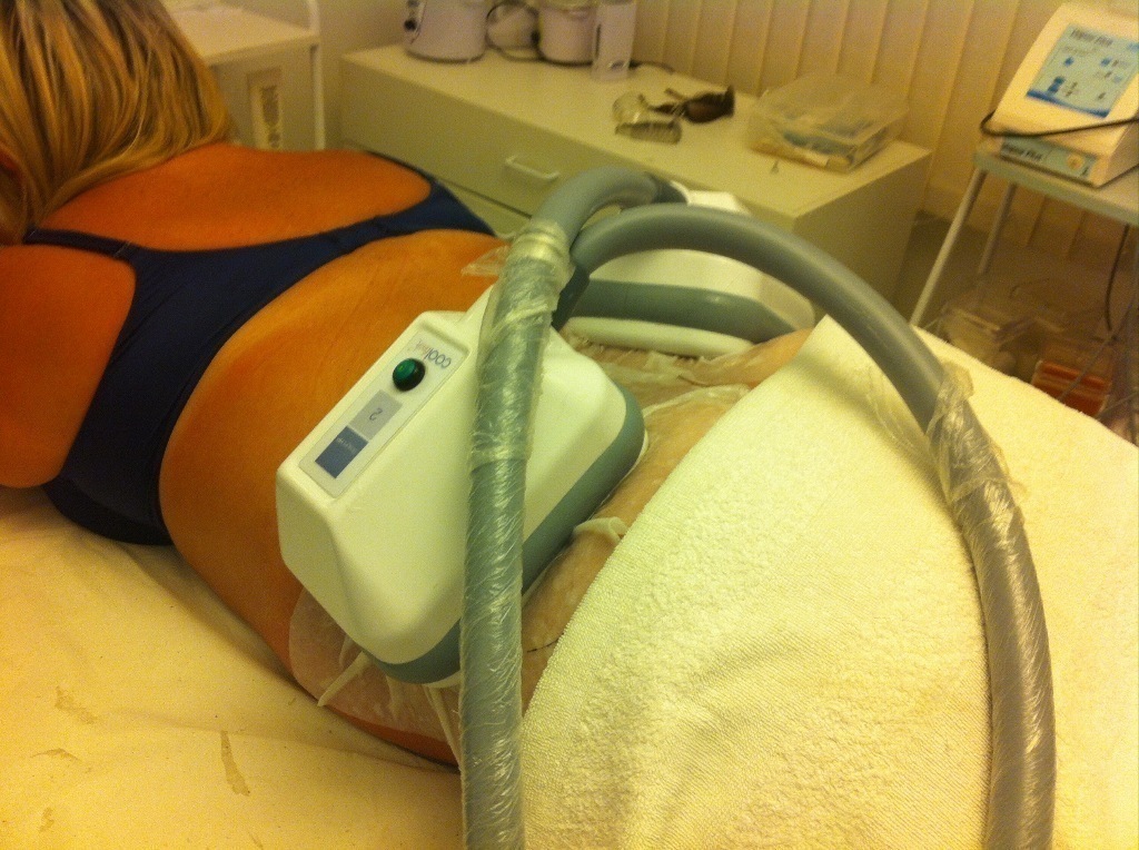 Eliminando as gordurinhas que tanto incomandam, 
Criolipólise equipamentos de ultima geração. esteticista massoterapeuta designer de sobrancelhas depilador(a)