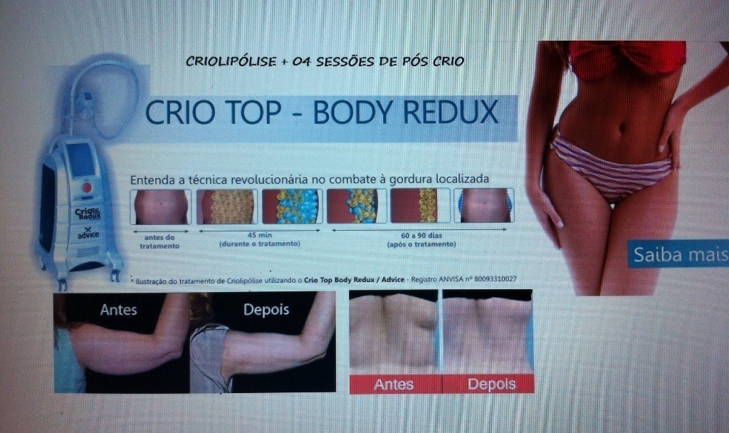 Aplicação segura  e eficaz.
Equipamento e mantas com registro na anvisa. esteticista massoterapeuta designer de sobrancelhas depilador(a)