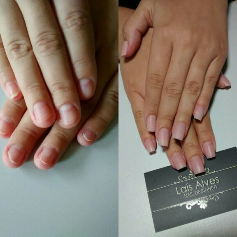 Alongamento de unhas em acrílico. unha manicure e pedicure manicure e pedicure