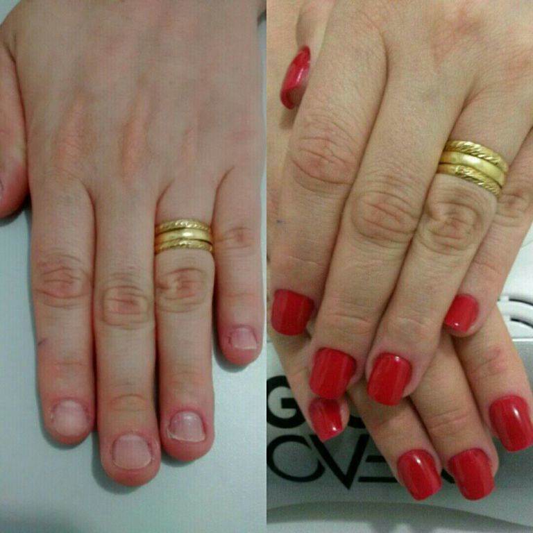 Alongamento de unhas em acrílico unha manicure e pedicure manicure e pedicure