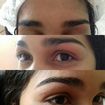 Sobrancelha