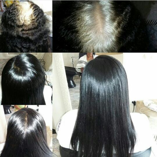 Coloração, antes e depois. cabelo cabeleireiro(a) esteticista massoterapeuta